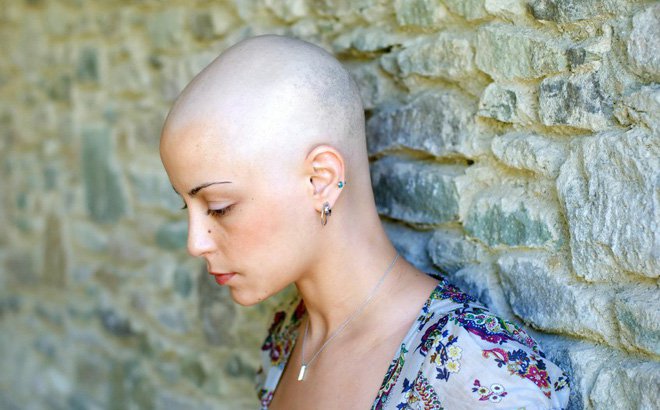 Mọc tóc sau hóa trị ung thư