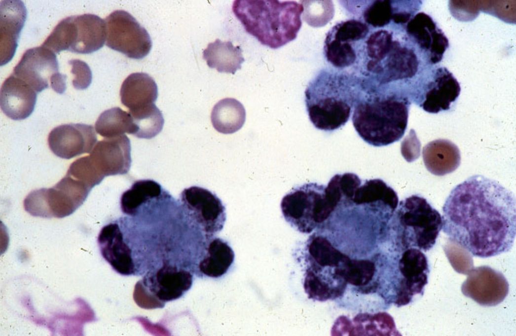 Tế bào Hargraves (tế bào LE)