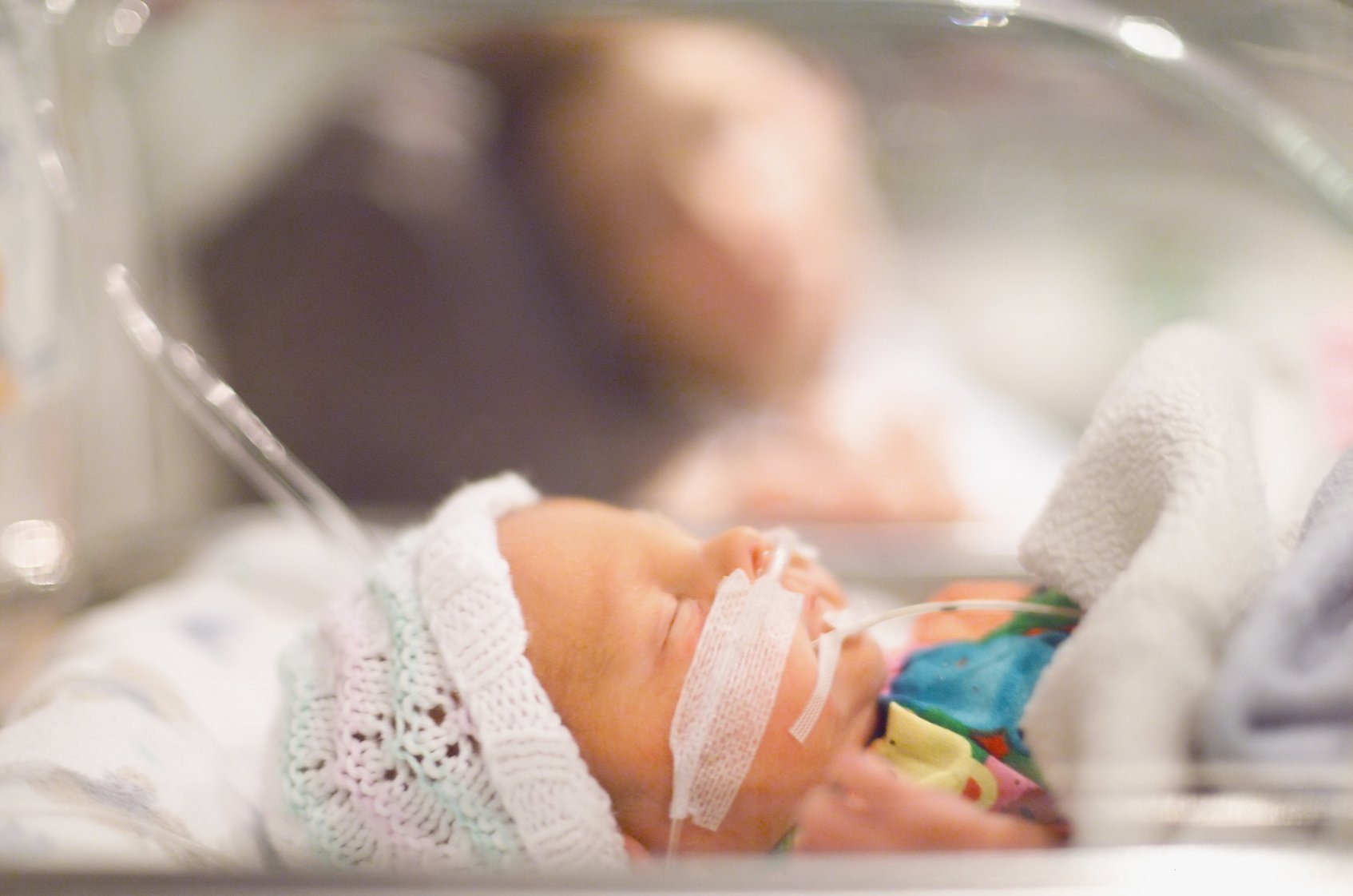 Loạn sản phổi ở trẻ sơ sinh