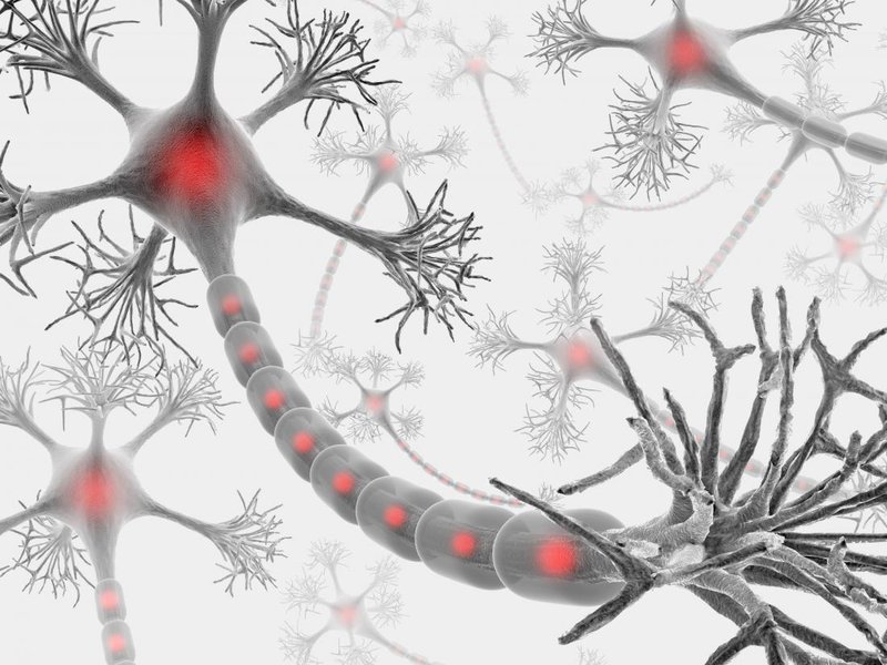 viêm đa dây thần kinh huỷ myelin mạn tính (CIDP)