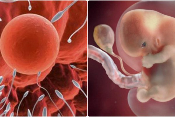 Trứng thụ thai với tinh trùng bất thường về hình dạng