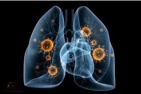 Sốt li bì không rõ nguyên nhân khi điều trị lao phổi có sao không?
