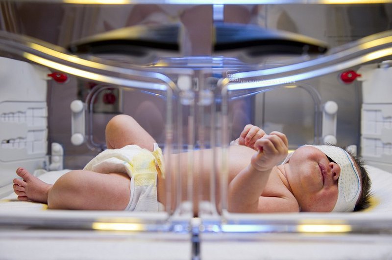 Trẻ sơ sinh bất đồng nhóm máu ABO đã điều trị bằng chiếu đèn có bị di chứng gì không?