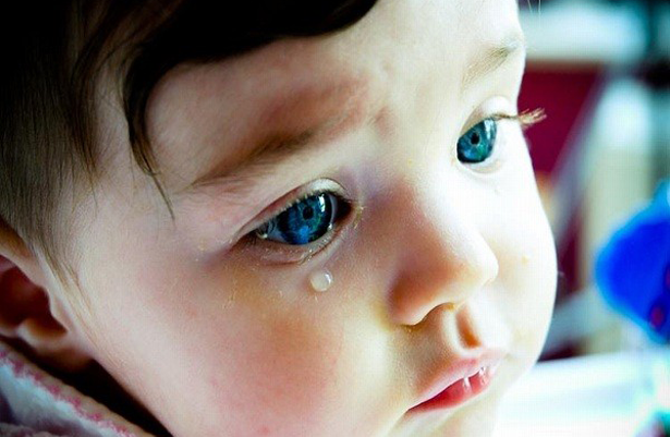 Trẻ 2 tuổi bị chảy nước mắt ở mắt trái 1 năm phải làm thế nào?