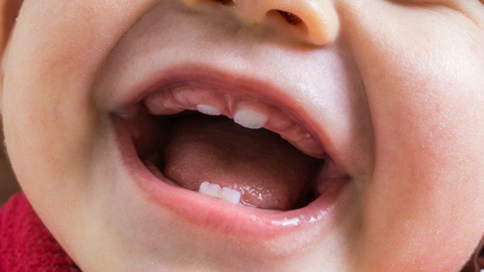 Bé 8 tháng tuổi mọc răng không theo thứ tự có sao không?