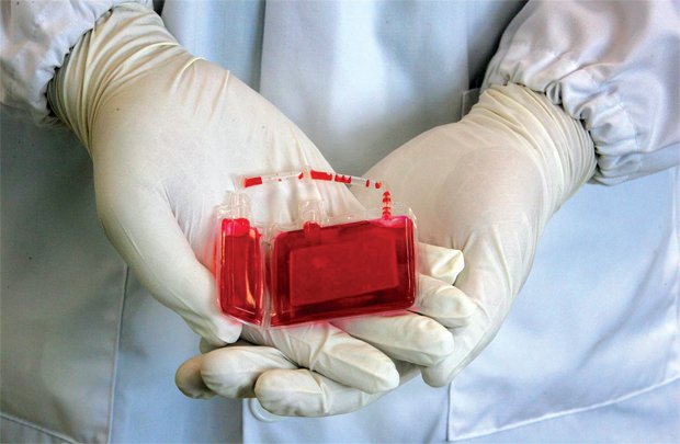 Tìm hiểu về ghép máu dây rốn: Thực trạng nghiên cứu lâm sàng