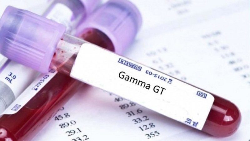 Chỉ số GGT cao là dấu hiệu bệnh gì?