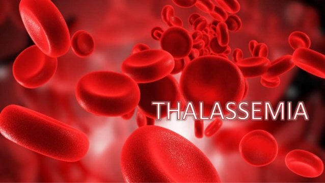 Ghép tế bào gốc cho người bị bệnh thalassemia được không?