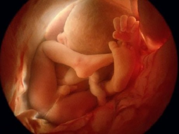 Mang thai 37 tuần có siêu âm 4D được không?