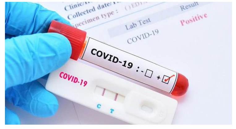 Sau nhiễm Covid bao lâu nên xét nghiệm PCR?