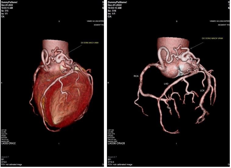 Chụp cắt lớp điện toán đa lát cắt (MSCT) – kĩ thuật chẩn đoán các bất thường tim mạch hiệu quả
