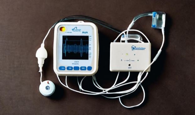 Máy holter điện tâm đồ là một thiết bị ghi lại hoạt động điện của tim