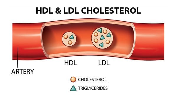 LDL-C là gì? Hiểu Rõ Về Cholesterol Xấu và Tác Động Đến Sức Khỏe