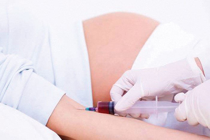 Xét nghiệm sàng lọc trước sinh không có DNA