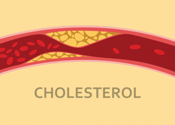 Mức cholesterol an toàn và cách duy trì