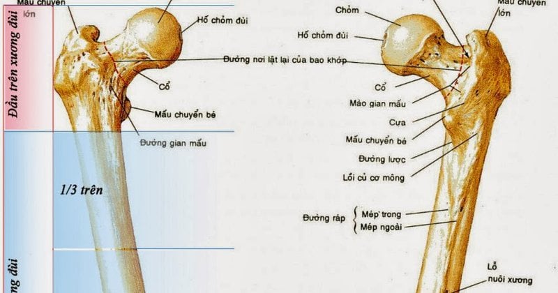 Gãy trên lồi cầu xương đùi: Thường gặp do chấn thương