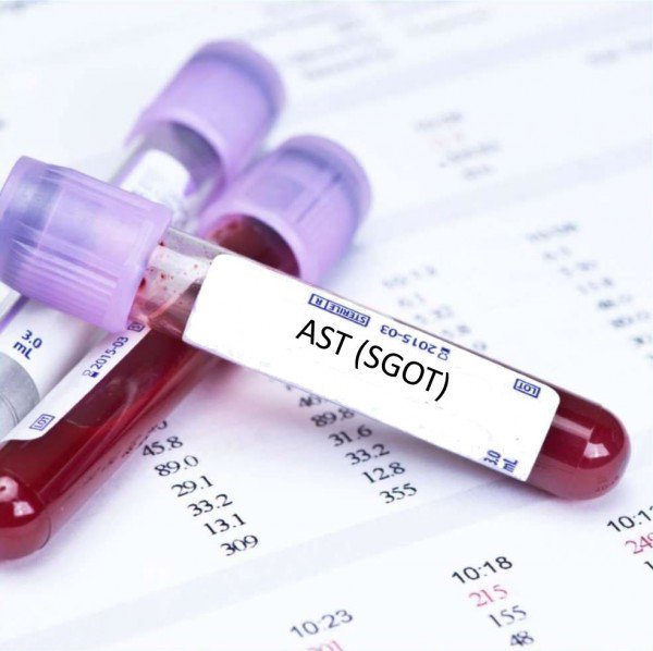 Định lượng AST máu là gì? - Tất cả những điều bạn cần biết