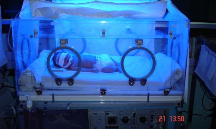 Chiếu đèn bức xạ cao điều trị vàng da ở trẻ sơ sinh
