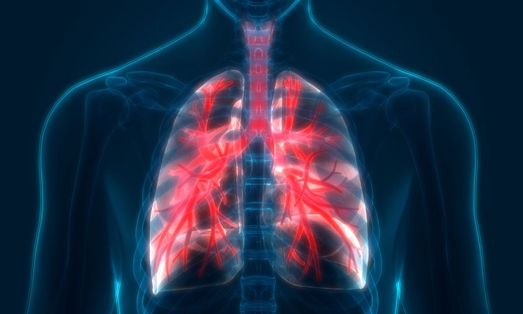 X quang COPD
