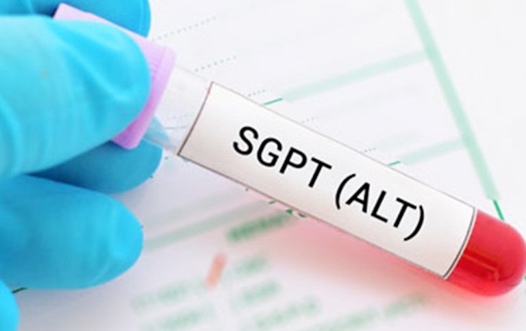 Triệu chứng liên quan đến tăng chỉ số SGPT/ALT