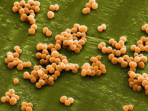 tụ cầu vàng (Staphylococcus aureus)