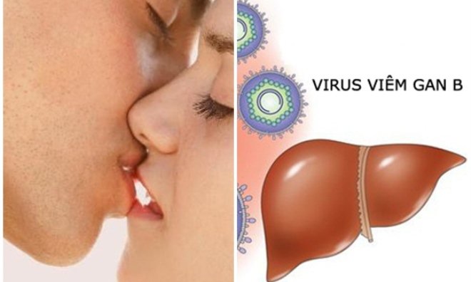 Viêm gan B qua đường tình dục bằng miệng