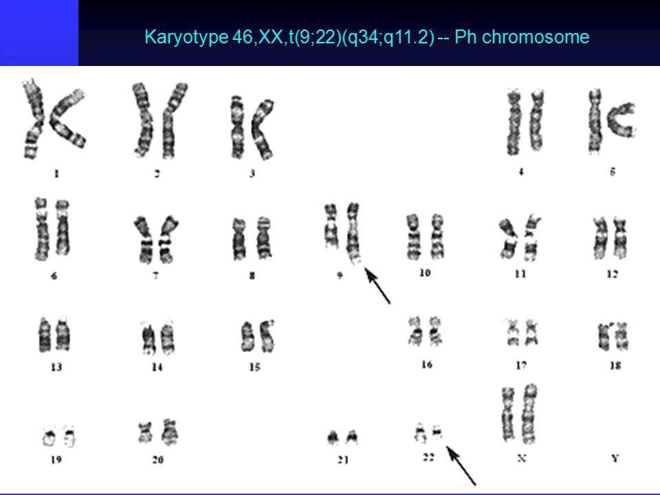 Karyotype bất thường