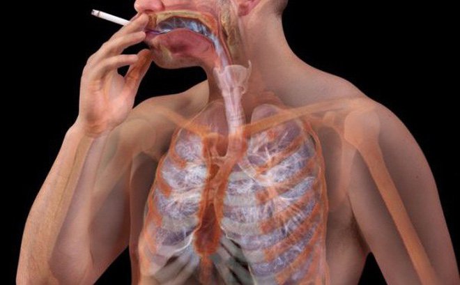 Thuốc lá ung thư phổi