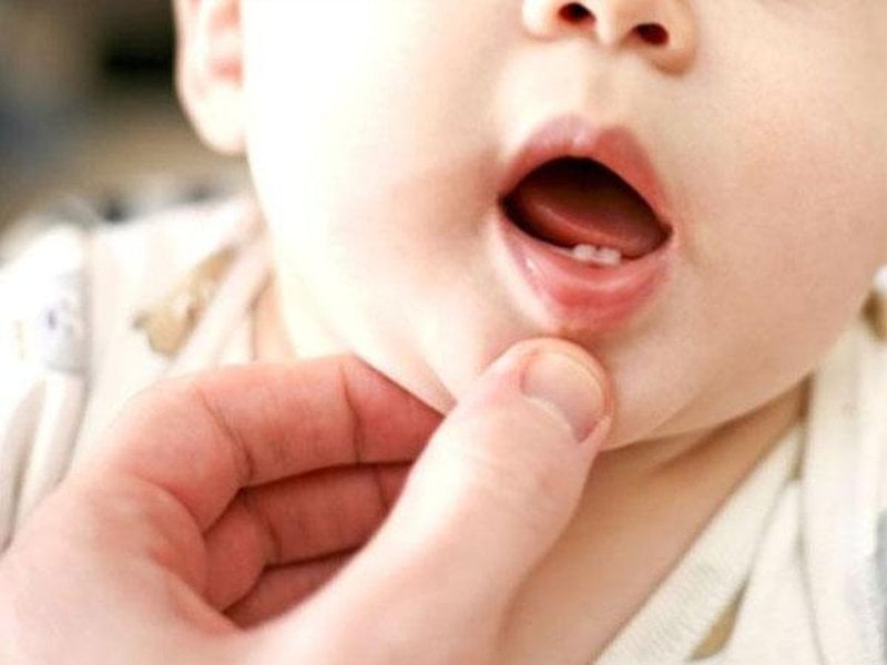 Xuất hiện vệt đen khi trẻ đang mọc răng sữa có sao không?