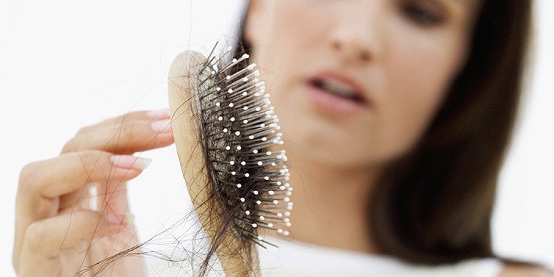 Rụng tóc là dấu hiệu của viêm tuyến giáp mạn tính Hashimoto