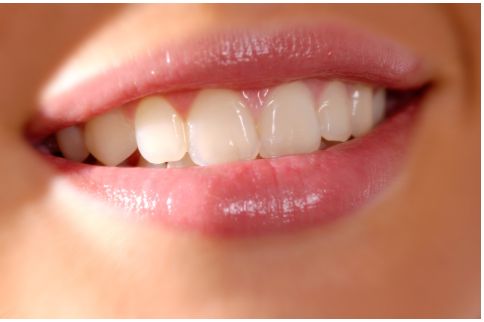 Nước có gas có ảnh hưởng đến sức khỏe răng miệng không?
