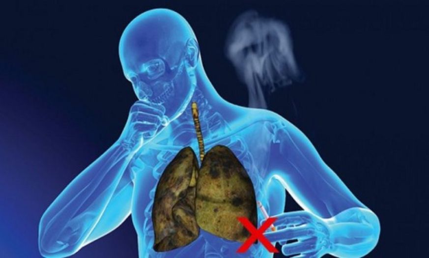 Hút thuốc bệnh phổi