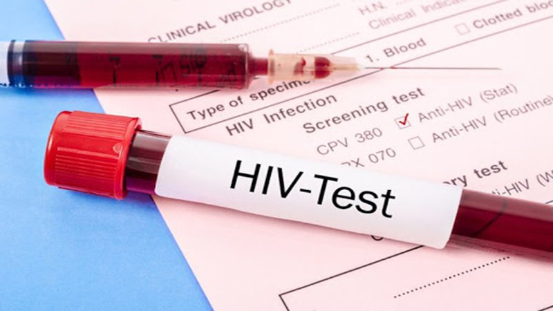 Làm xét nghiệm HIV khi xuất hiện phát ban