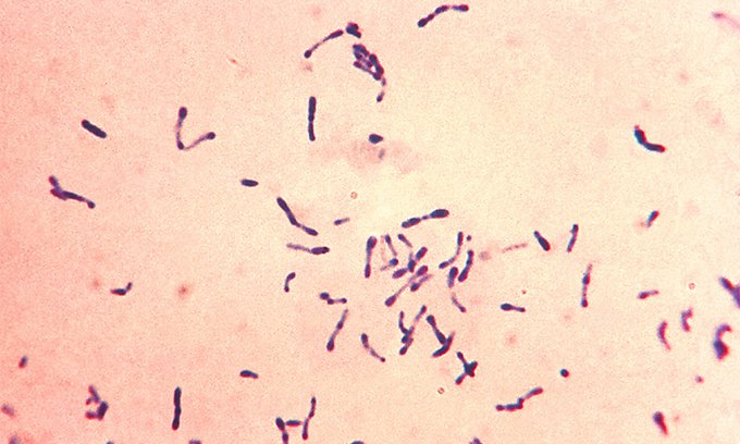 Vi khuẩn Corynebacterium diphtheriae gây ra bệnh bạch hầu