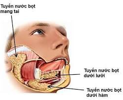 Viêm tuyến nước bọt dưới hàm do sỏi