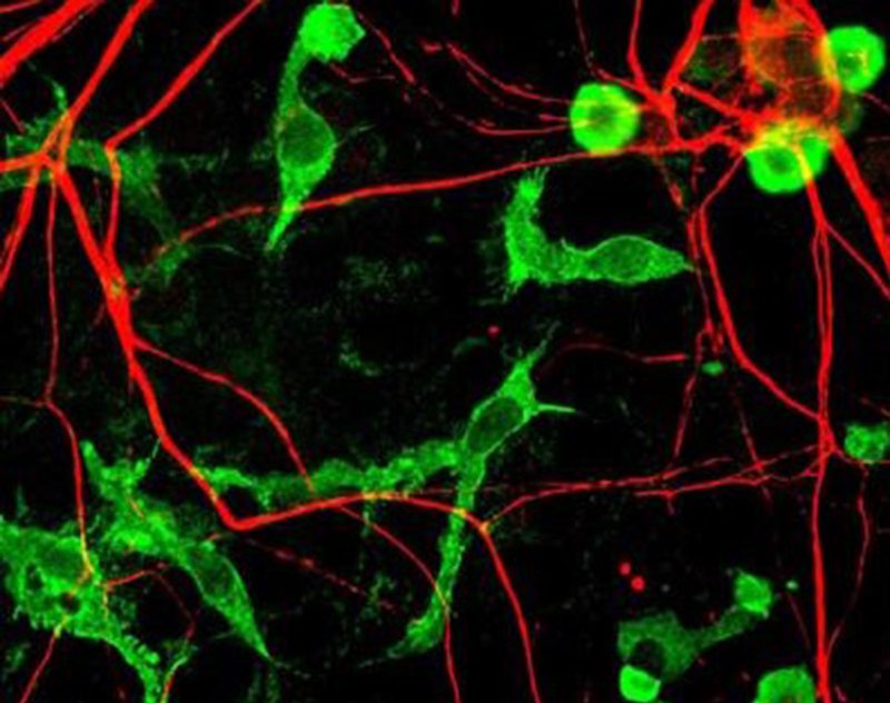 microglia xâm nhập mạch máu não