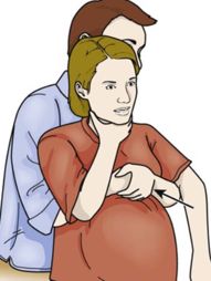 sơ cứu nghẹt thở cho phụ nữ mang thai