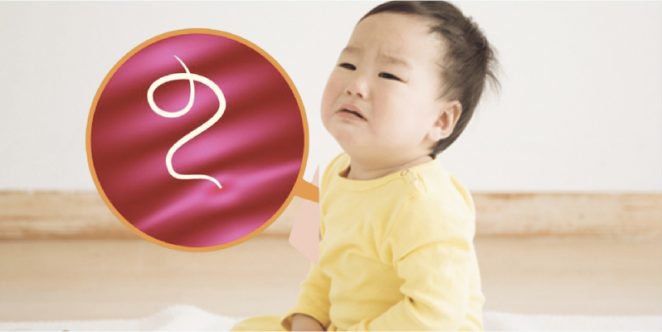 Điều trị giun chui ống mật ở trẻ?