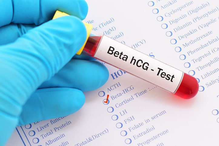 Test kích thích bằng HCG