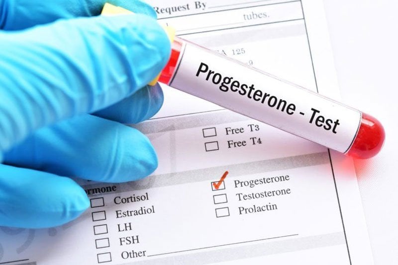 Xét nghiệm Progesterone