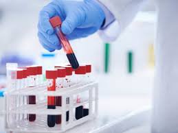 Xét nghiệm tổng phân tích tế bào máu ngoại vi