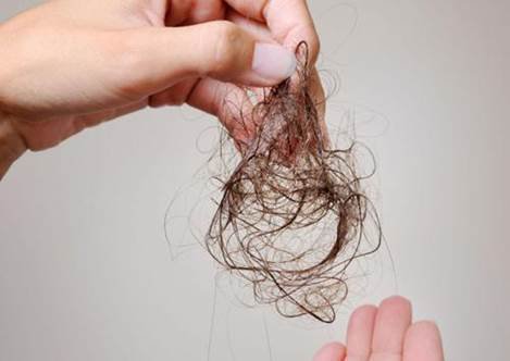 Rụng tóc khi uống thuốc điều trị viêm đa cơ bao lâu có thể mọc lại?