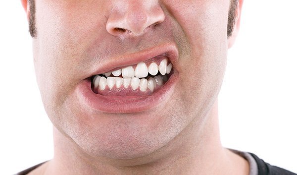 Nghiến răng hàm gây cứng cổ