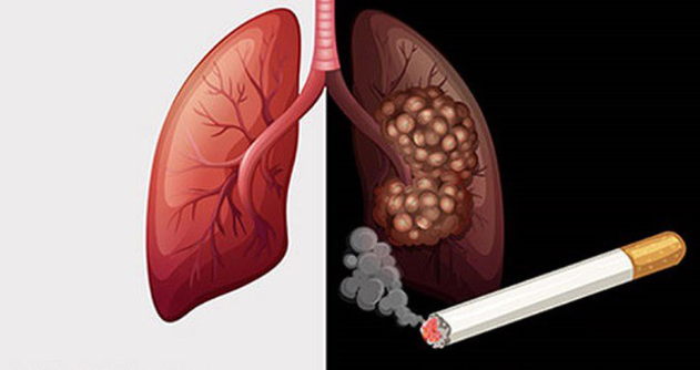 Cách ngăn chặn nguy cơ ung thư do hút thuốc lá?