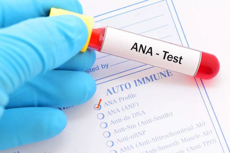 Ứng dụng của ANA Test trong y học
