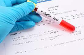 Kết quả xét nghiệm rubella