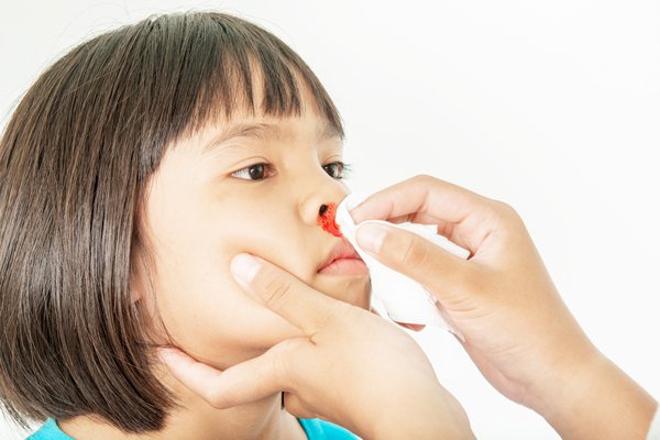 điều trị chảy máu mũi ở trẻ