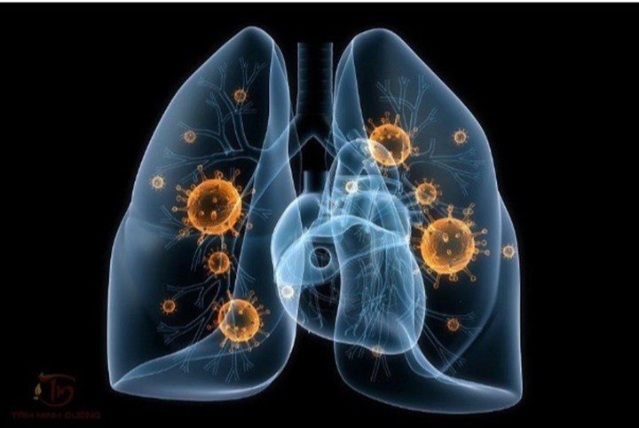 Thuốc Rifater có tác dụng điều trị bệnh lao phổi