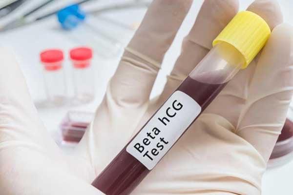 Xét nghiệm HCG 153, ra máu có phải thai ngoài tử cung không?