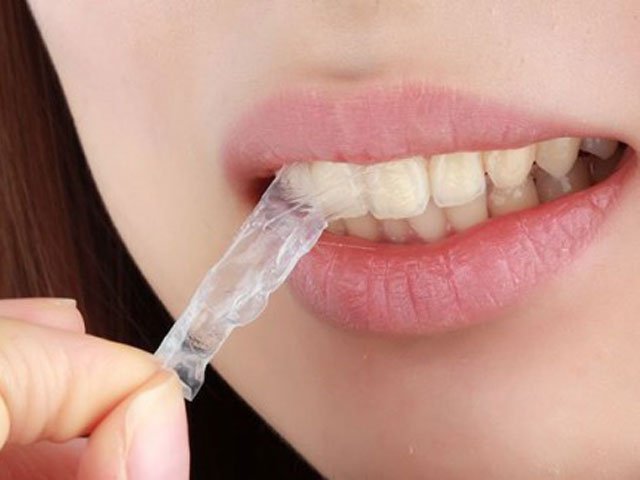 Bạn có thể dùng miếng dán trắng răng và không nên tẩy trắng răng nhiều quá
